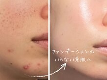 パールホワイトニングサロン 辻堂店