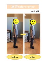 いみすぽ整体/60代女性ビフォアアフター