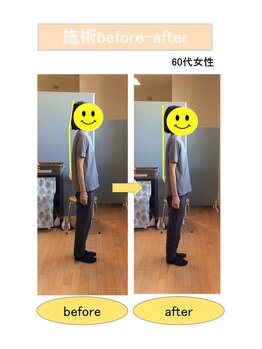 いみすぽ整体/60代女性ビフォアアフター