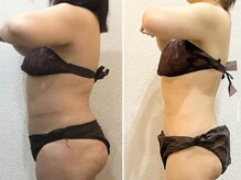 美容整体 ウェリナ 蟹江院/小顔矯正/骨盤矯正/美脚サロン