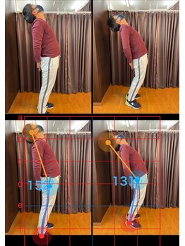 やぎはし整体院 篠籠田店/AI分析:姿勢ビフォーアフター