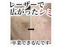 ポア(Pois)