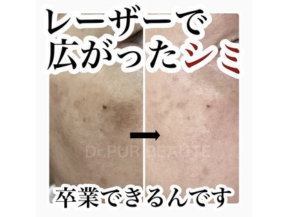 ポア(Pois)の写真