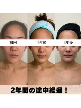 お顔の研究所/ビフォーアフター写真♪