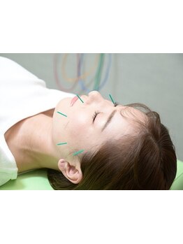 鍼灸施術を受けたい