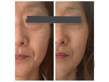 ビーマジック(美magic)/サーマトリックス