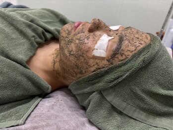 ビューティーサロン リリー(Lily)の写真/毛穴悩み徹底改善★従来のハイドラフェイシャルで毛穴の汚れを除去+話題の水素ピーリングでうるツヤ肌へ