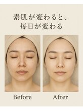 リードン(Reedon)/リラクゼーションエステ