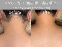 グランビューティーサロン(grand beauty salon)/うなじ～肩甲骨