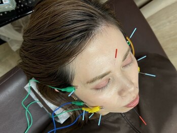 風香る鍼灸院の写真/鍼灸で眼精疲労をリセット*花粉による目のトラブル「目の周りが痒い、しょぼしょぼ、重ダルい。」