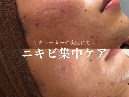 ルアナアイナ 大分の写真