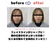 ユー(You)の写真