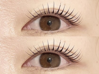 エルブリンク(elblink)の写真