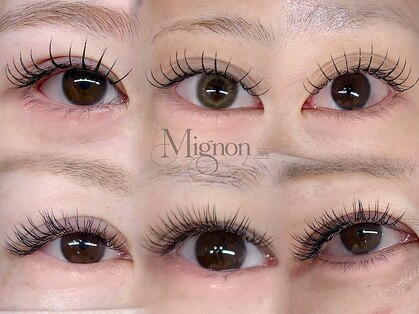 ミニョン(Mignon)の写真