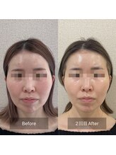 ラ クレール ビューティーサロン(LA CLAIR)/小顔リフトマシン豊富に取り揃え