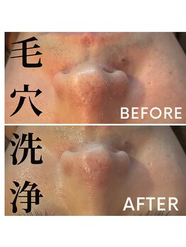 シュウア(SyuA)/メンズフェイシャル