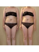 ココア(CoCoa)/活性リンパ洗浄