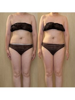 ココア(CoCoa)/活性リンパ洗浄