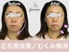【8月限定】夏のむくみ改善×小顔ケア！疲れ顔もすっきり￥19800→￥8980
