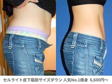 アンシャンテ 神戸元町店(Enchante)/痩身ダイエット　神戸元町三ノ宮