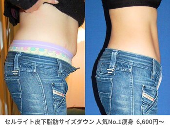 アンシャンテ 神戸元町店(Enchante)/痩身ダイエット　神戸元町三ノ宮