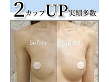 女性専用・完全個室なので安心してバストアップに望めます♪