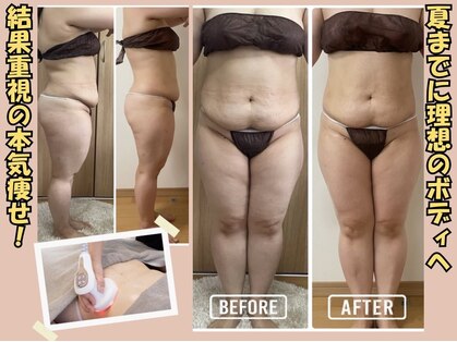 プラム(plum)の写真