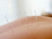 鍼灸からだケア 元住吉 ［肩凝り・腰痛改善/もみほぐし・ストレッチ・リンパ・整体］/