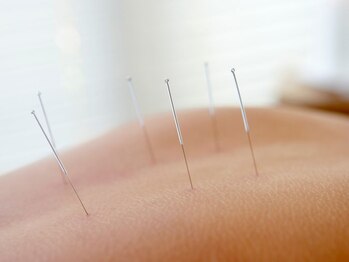 鍼灸からだケア 元住吉 ［肩凝り・腰痛改善/もみほぐし・ストレッチ・リンパ・整体］/