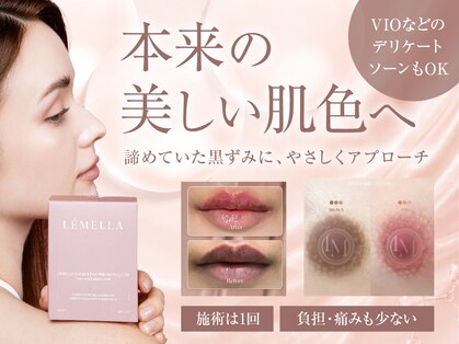 ソエル(SOEL)の写真