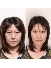 リスプリヴェ(Lis Prive)/まぶたがかぶさり目尻にシワが…