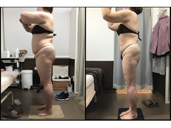 リッツ 草加店(Ritz)/【Before/After】痩身