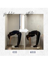 ラクリエ 東加古川院(La Creer)/お客様ビフォーアフター