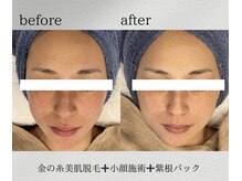 カリス(charis)/速攻小顔！