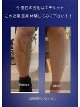インプルーブ エステティック(Improve ESTHETIC)/