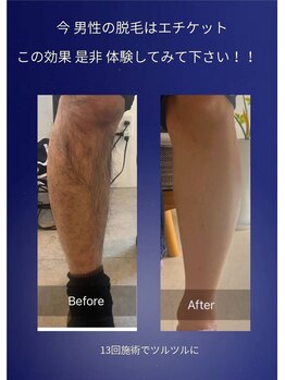 インプルーブ エステティック(Improve ESTHETIC)/