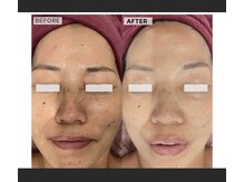 パールブルー(All Perl blue)/韓国白玉美肌ケア