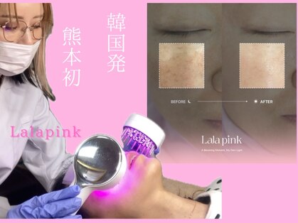 カルム(Calme)の写真