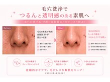 ブロン(Blanc)の雰囲気（男性にも人気！リピート97%毛穴洗浄でツルスベ肌）