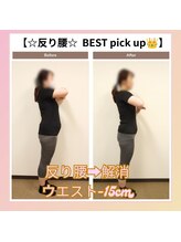 えのもと美容整体院/【反り腰の解消】
