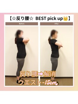 えのもと美容整体院/【反り腰の解消】
