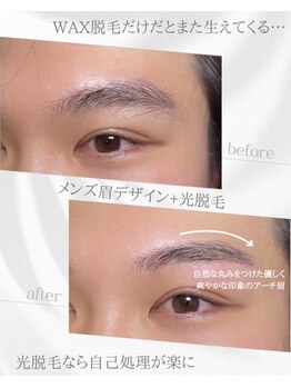 リノア(Linoa)/メンズ眉毛ビフォーアフター