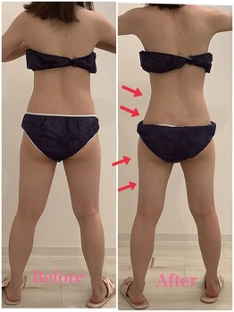 スペチアーレ 夙川/脂肪細胞の数を減らせるメニュー