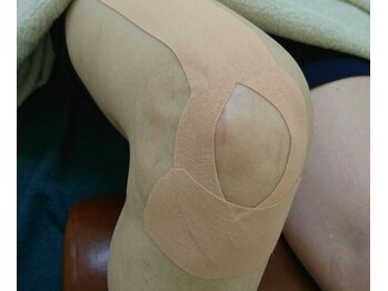 すずらん接骨院/キネシオテープ