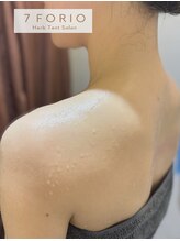 セブンフォリオ(7FORIO)/嬉しくなるお肌の変化