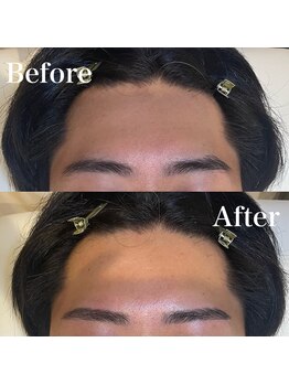 モテテ(motete)/お客様施術例☆栄本店