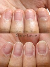 マリーロール 淀屋橋本店(Marie Laure)/自爪育成/深爪矯正/ネイルケア