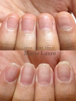 マリーロール 淀屋橋本店(Marie Laure)/自爪育成/深爪矯正/ネイルケア