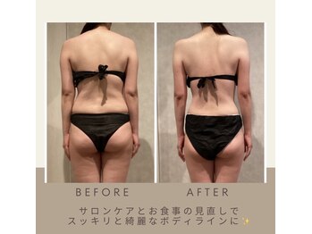 ラシク 北堀江店(LACHIC)/くびれライン