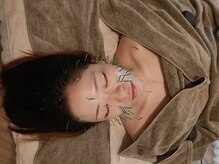 サルビア(SALVIA)/美容鍼 月1ケアで美しさをキープ